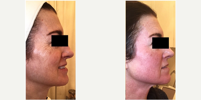before and after image
