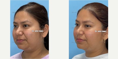 before and after image