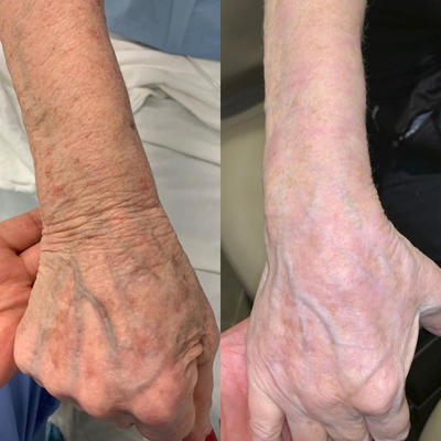 before and after image
