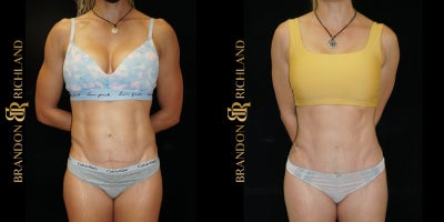 before and after image