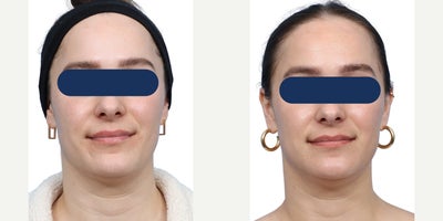 before and after image