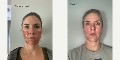 ActiveFX before and after photo