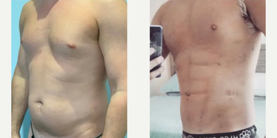 before and after image