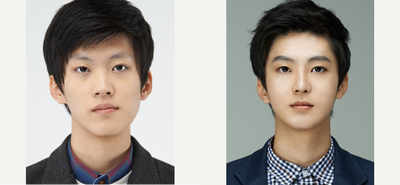 Facial before and after photo