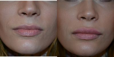 before and after image