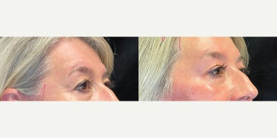before and after image