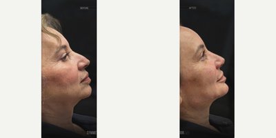 before and after image