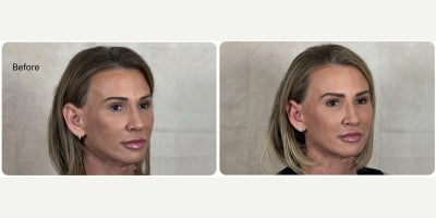 before and after image