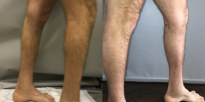 before and after image
