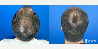 before and after image