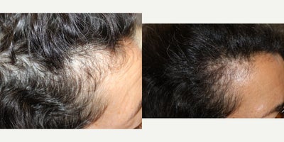 before and after image