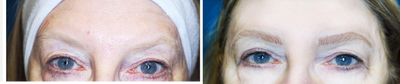 Microblading before and after photo