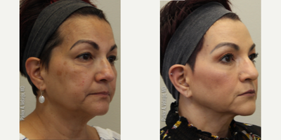before and after image