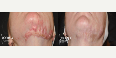 before and after image