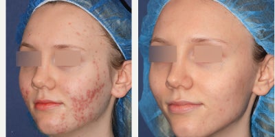 before and after image