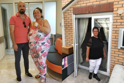 Gastric Sleeve Surgery before and after photo