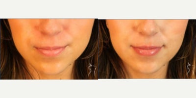 before and after image