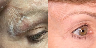 before and after image