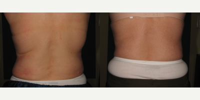 before and after image