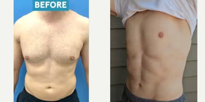before and after image