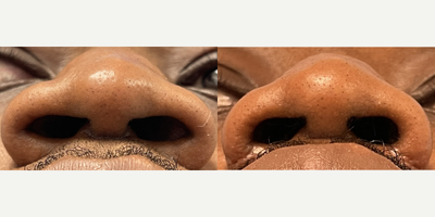 before and after image