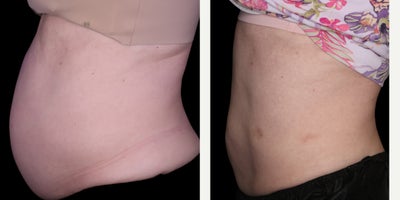 before and after image