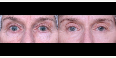 before and after image