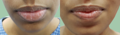 before and after image