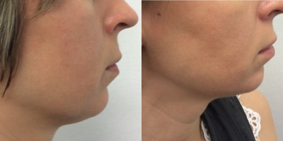 before and after image