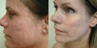 before and after image