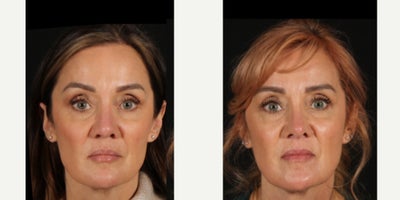 before and after image