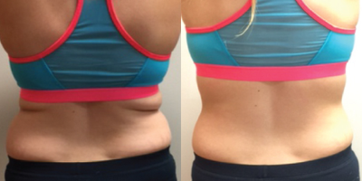 before and after image