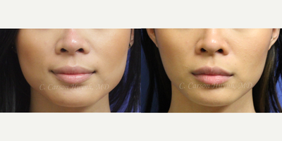 before and after image