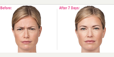 before and after image