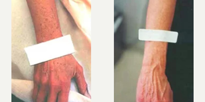 before and after image