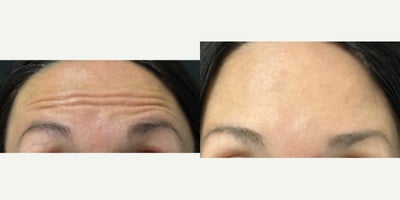before and after image