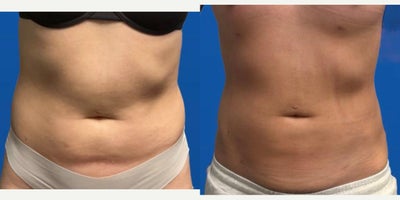 before and after image