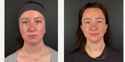 before and after image