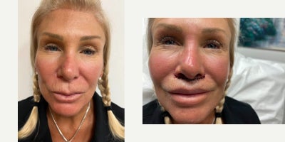 before and after image