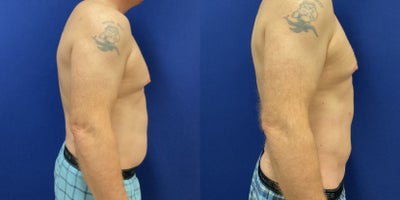 before and after image