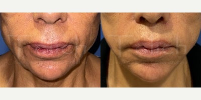 before and after image