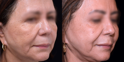 before and after image