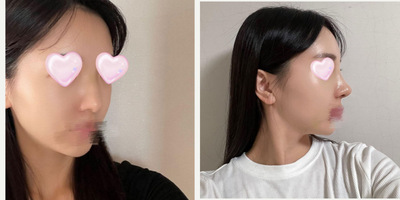 before and after image