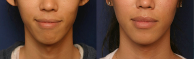 before and after image