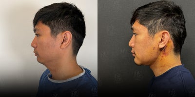 before and after image