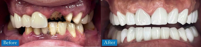 before and after image