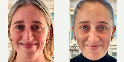 before and after image