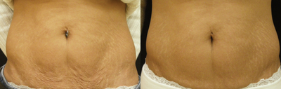 before and after image