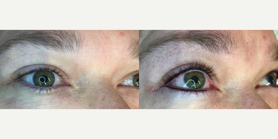 Permanent Makeup before and after photo