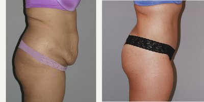before and after image